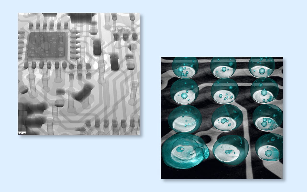 4. 2D vs 3D CT X-ray Which One Do You Really Need? 4. سی تی اشعه ایکس دو بعدی در مقابل سه بعدی به کدام یک واقعا نیاز دارید؟