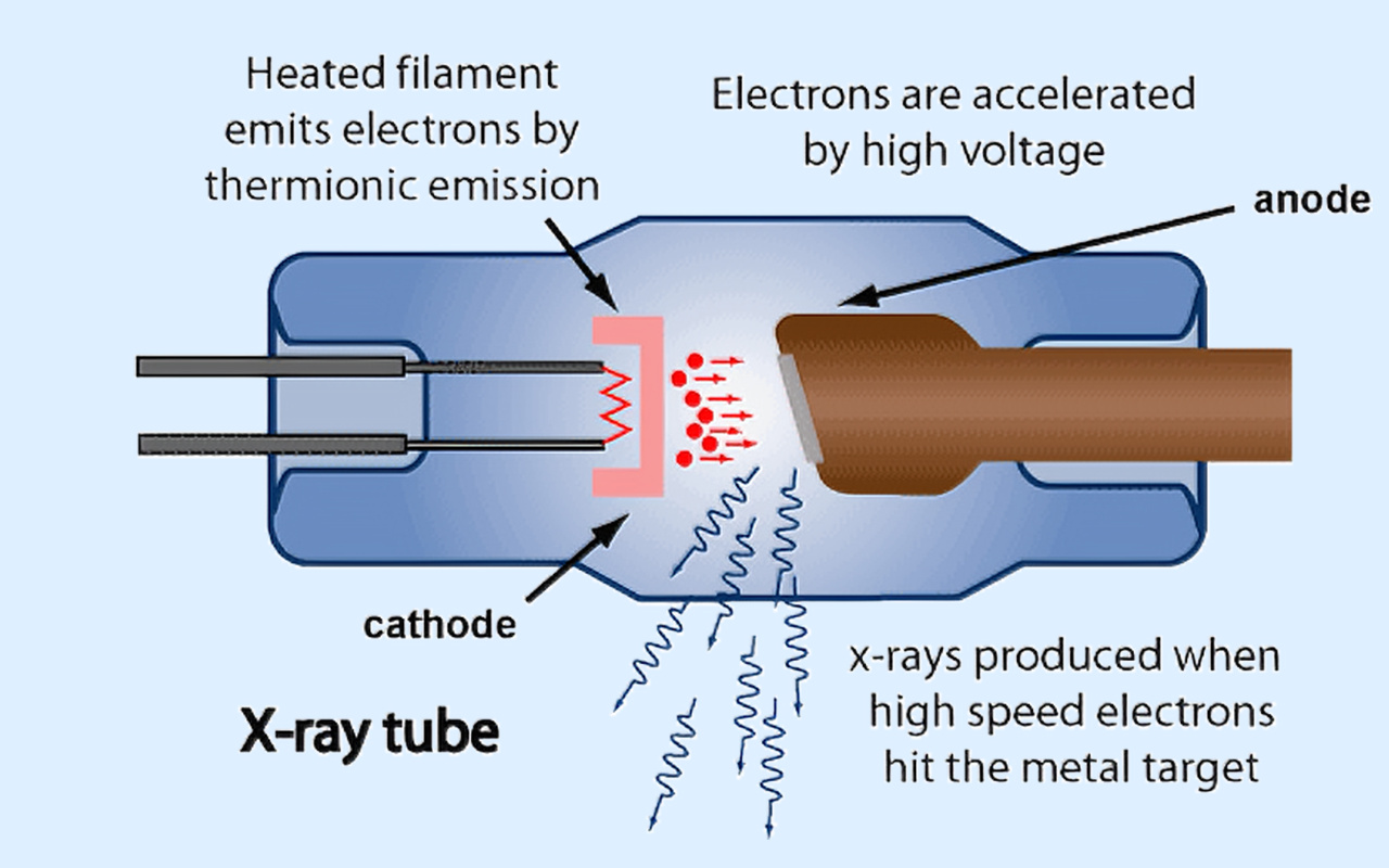 2. What X-ray Technology Actually Does 2. فناوری اشعه ایکس در واقع چه می کند